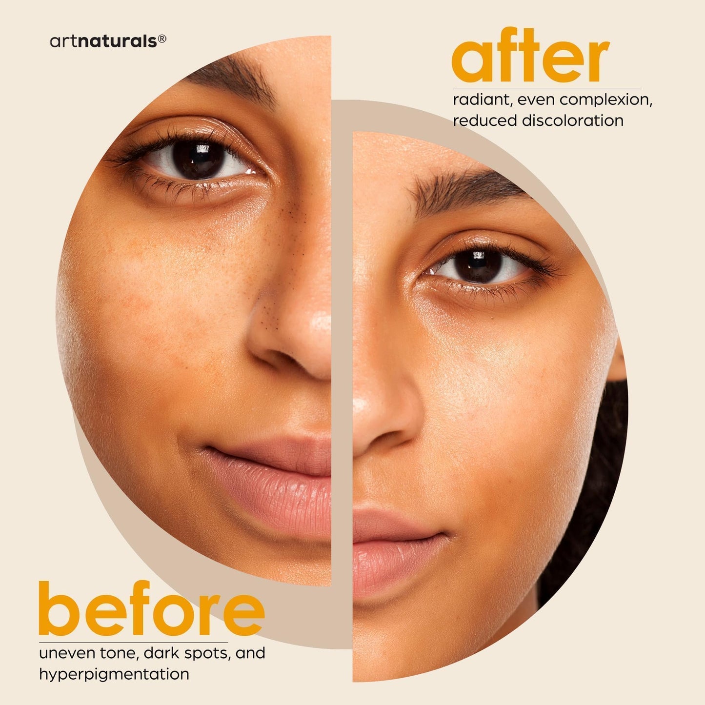 Kojic Acid & Turmeric Soap Dark Spot Remover