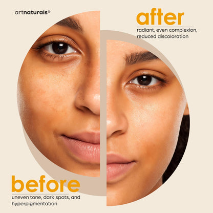 Kojic Acid & Turmeric Soap Dark Spot Remover